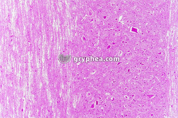 Moelle épinière CL niveau cornes antérieures x25 - gryphea.com